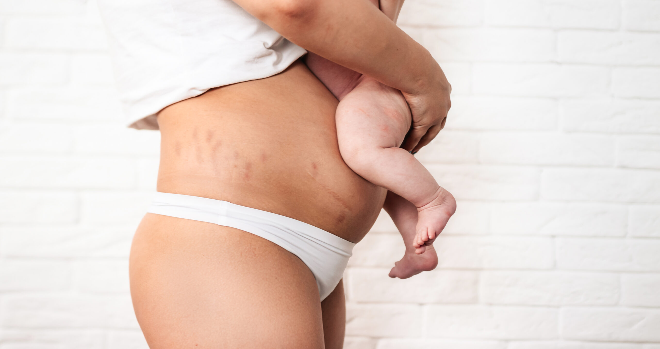The belly of a woman after the birth of a child. Baby's legs on a woman's stomach on a white background.